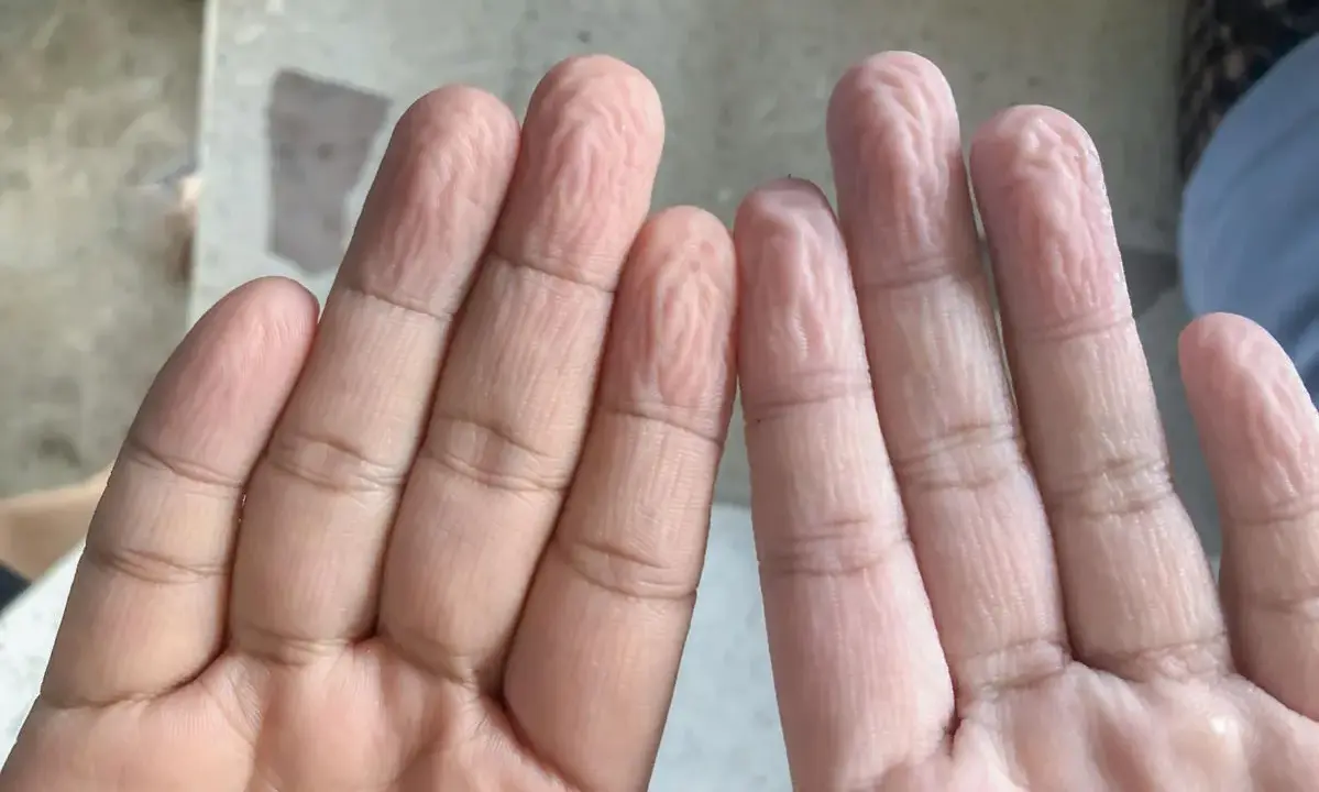 Dita raggrinzite in acqua, un fenomeno che ci fa chiedere perché le mani si raggrinziscono subito in acqua.