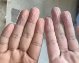 Dita raggrinzite in acqua, un fenomeno che ci fa chiedere perché le mani si raggrinziscono subito in acqua.