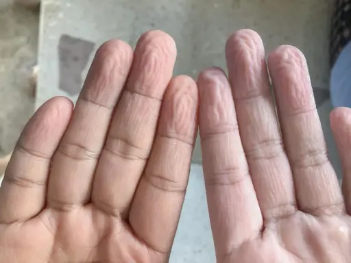Dita raggrinzite in acqua, un fenomeno che ci fa chiedere perché le mani si raggrinziscono subito in acqua.