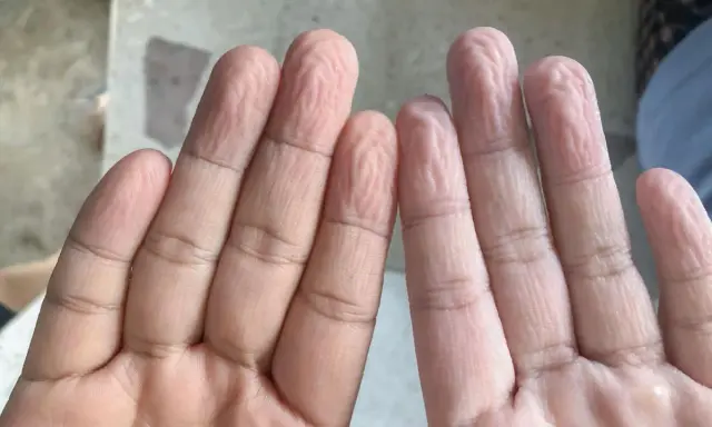 Dita raggrinzite in acqua, un fenomeno che ci fa chiedere perché le mani si raggrinziscono subito in acqua.