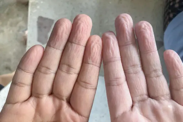 Dita raggrinzite in acqua, un fenomeno che ci fa chiedere perché le mani si raggrinziscono subito in acqua.